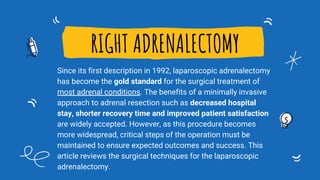 RIGHT ADRENALECTOMY
Since its first description in 1992, laparoscopic adrenalectomy
has become the gold standard for the surgical treatment of
most adrenal conditions. The benefits of a minimally invasive
approach to adrenal resection such as decreased hospital
stay, shorter recovery time and improved patient satisfaction
are widely accepted. However, as this procedure becomes
more widespread, critical steps of the operation must be
maintained to ensure expected outcomes and success. This
article reviews the surgical techniques for the laparoscopic
adrenalectomy.
 