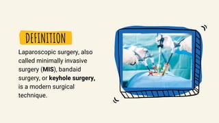 DEFINITION
Laparoscopic surgery, also
called minimally invasive
surgery (MIS), bandaid
surgery, or keyhole surgery,
is a modern surgical
technique.
 