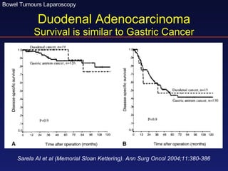Duodenal Adenocarcinoma Survival is similar to Gastric Cancer Sarela AI et al (Memorial Sloan Kettering). Ann Surg Oncol 2004;11:380-386 