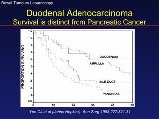 Duodenal Adenocarcinoma Survival is distinct from Pancreatic Cancer Yeo CJ et al (Johns Hopkins). Ann Surg 1998;227:821-31 