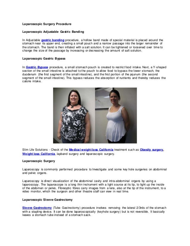 Laparoscopic surgery procedure