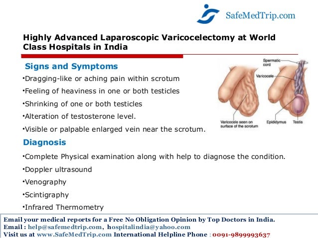 What Is The Risk Of Laparoscopic Varicocelectomy? – VULCG