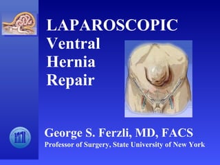 LAPAROSCOPIC  Ventral  Hernia  Repair George S. Ferzli, MD, FACS Professor of Surgery, State University of New York 