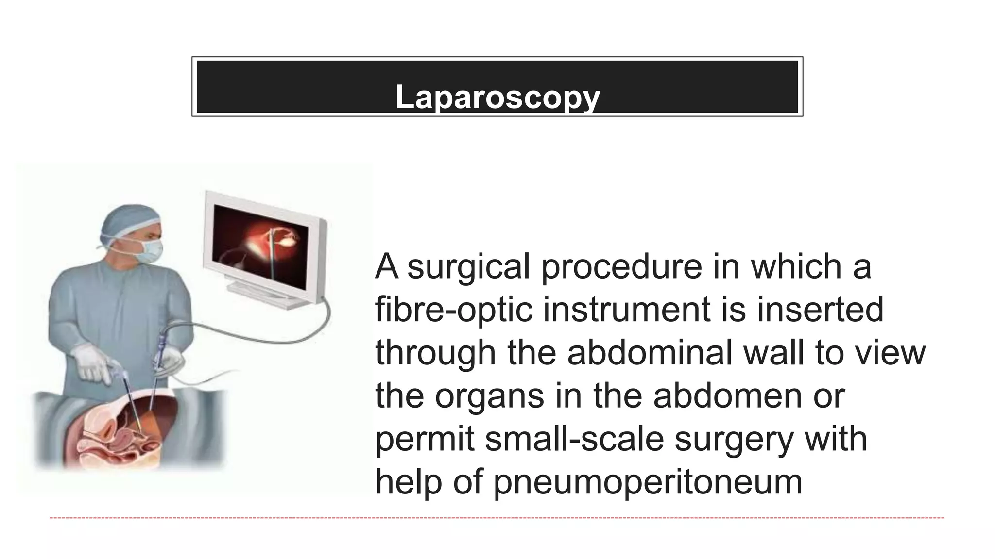 Laparoscopy
A surgical procedure in which a
fibre-optic instrument is inserted
through the abdominal wall to view
the organs in the abdomen or
permit small-scale surgery with
help of pneumoperitoneum
 