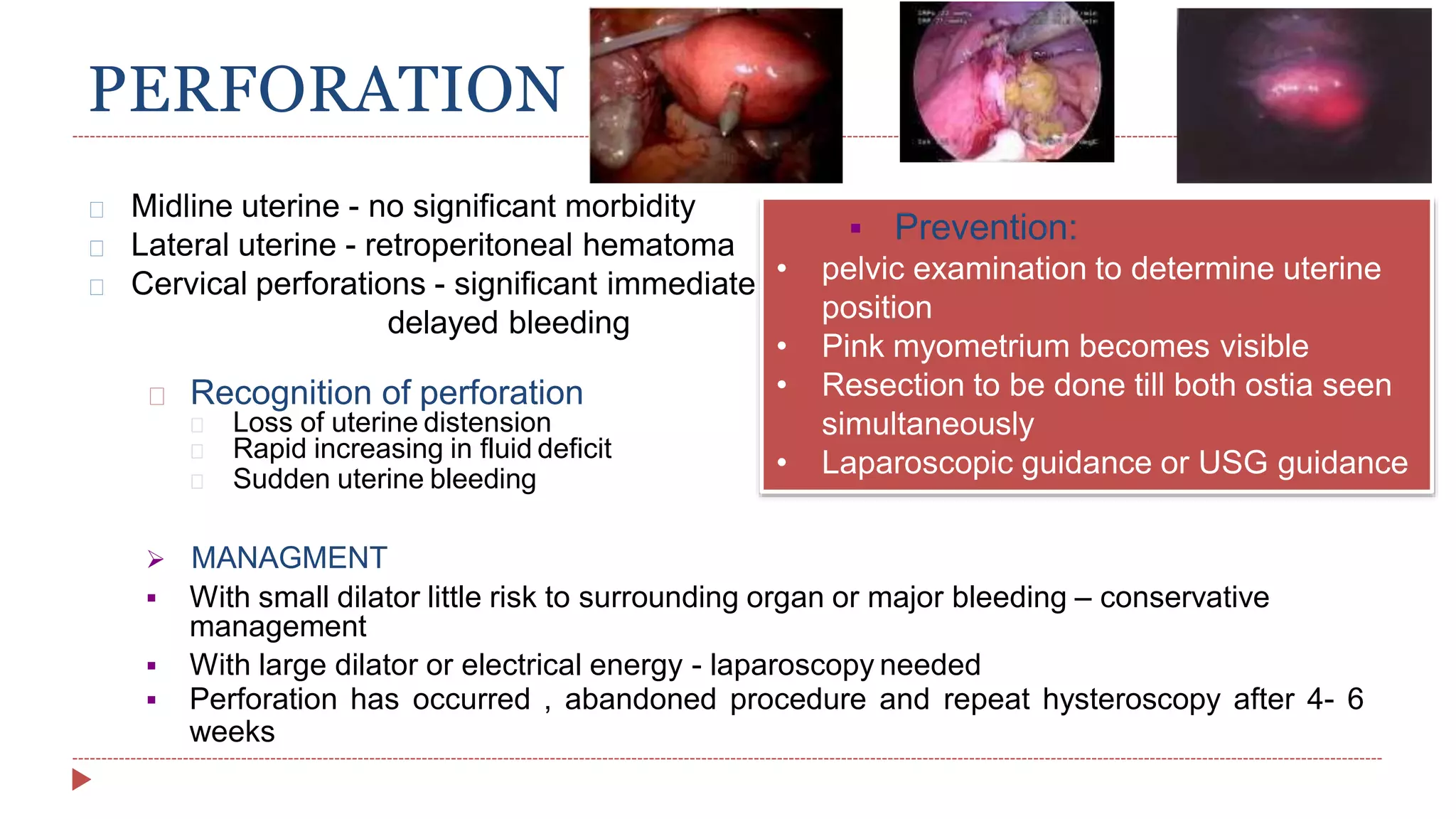 PERFORATION
or
Midline uterine - no significant morbidity
Lateral uterine - retroperitoneal hematoma
Cervical perforations - significant immediate
delayed bleeding
Recognition of perforation
Loss of uterine distension
Rapid increasing in fluid deficit
Sudden uterine bleeding
 MANAGMENT
 With small dilator little risk to surrounding organ or major bleeding – conservative
management
 With large dilator or electrical energy - laparoscopy needed
 Perforation has occurred , abandoned procedure and repeat hysteroscopy after 4- 6
weeks
 Prevention:
• pelvic examination to determine uterine
position
• Pink myometrium becomes visible
• Resection to be done till both ostia seen
simultaneously
• Laparoscopic guidance or USG guidance
 
