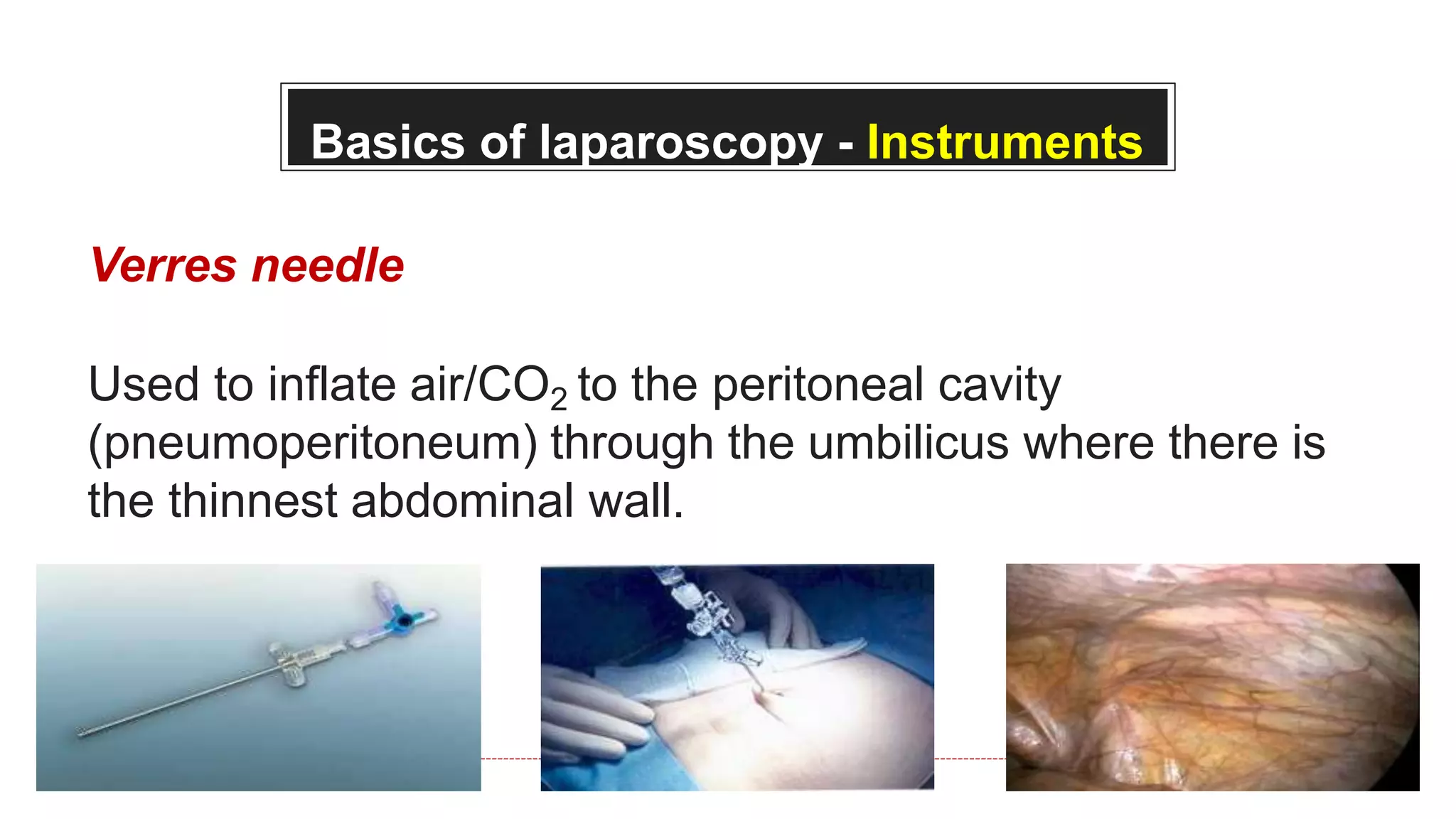 Basics of laparoscopy - Instruments
Verres needle
Used to inflate air/CO2 to the peritoneal cavity
(pneumoperitoneum) through the umbilicus where there is
the thinnest abdominal wall.
 