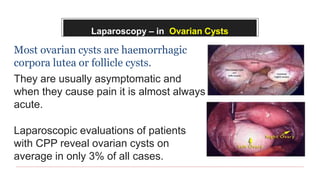 Laparoscopy – in Ovarian Cysts
Most ovarian cysts are haemorrhagic
corpora lutea or follicle cysts.
They are usually asymptomatic and
when they cause pain it is almost always
acute.
Laparoscopic evaluations of patients
with CPP reveal ovarian cysts on
average in only 3% of all cases.
 