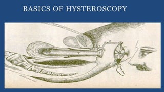 BASICS OF HYSTEROSCOPY
 