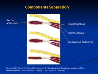 Grevious MA. Cohen M. Shah SR. Rodriguez P.  Structural and functional anatomy of the abdominal wall.   Clinics in Plastic Surgery. 33(2):169-79, v, 2006 Apr. External oblique Internal oblique Transversus abdominis Rectus abdominis Components Separation 