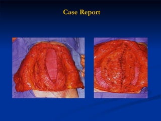 Case Report 