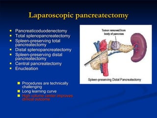 Laparoscopic pancreatectomy Pancreaticoduodenectomy  Total splenopancreatectomy Spleen-preserving total pancreatectomy Distal splenopancreatectomy Spleen-preserving distal pancreatectomy Central pancreatectomy Enucleation  Procedures are technically challenging Long learning curve High volume center improves clinical outcome 