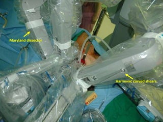 Maryland dissector Harmonic curved shears 