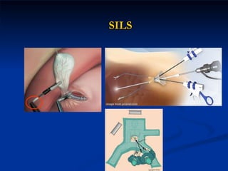 SILS 