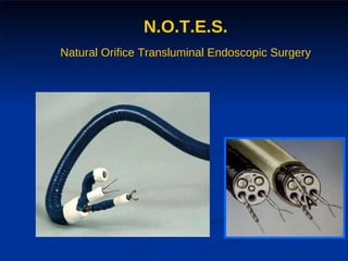 N.O.T.E.S. Natural Orifice Transluminal Endoscopic Surgery 