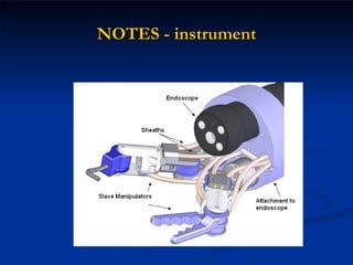 NOTES - instrument 