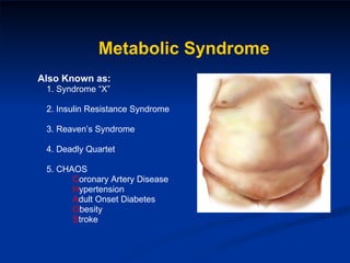Metabolic Syndrome Also Known as: 1. Syndrome “X” 2. Insulin Resistance Syndrome 3. Reaven’s Syndrome 4. Deadly Quartet 5. CHAOS C oronary Artery Disease H ypertension A dult Onset Diabetes O besity S troke  