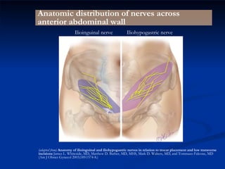 (adapted from)  Anatomy of ilioinguinal and iliohypogastric nerves in relation to trocar placement and low transverse incisions  James L. Whiteside, MD, Matthew D. Barber, MD, MHS, Mark D. Walters, MD, and Tommaso Falcone, MD (Am J Obstet Gynecol 2003;189:1574-8.) Anatomic distribution of nerves across anterior abdominal wall Iliohypogastric nerve Ilioinguinal nerve 