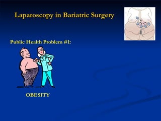 Public Health Problem #1: Laparoscopy in Bariatric Surgery OBESITY 