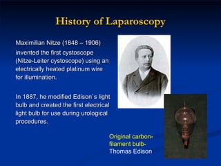 History of Laparoscopy Maximilian Nitze (1848 – 1906)  invented the first cystoscope ( Nitze-Leiter cystoscope) using an electrically heated platinum wire for illumination . In 1887, he modified Edison`s light bulb and created the first electrical light bulb for use during urological procedures. Original carbon-filament bulb-  Thomas Edison  