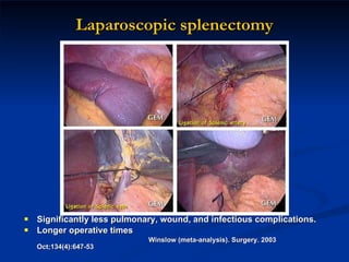 Laparoscopic splenectomy Significantly less pulmonary, wound, and infectious complications. Longer operative times  Winslow (meta-analysis). Surgery. 2003 Oct;134(4):647-53 