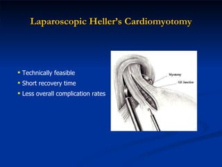 Laparoscopic Heller’s Cardiomyotomy Technically feasible Short recovery time Less overall complication rates 