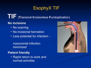 EsophyX TIF TIF   ( T ransoral  I ncisionless  F undoplication) No incisions No scarring No incisional herniation Less potential for infection -  nosocomial infection minimized Patient friendly  Rapid return to work and normal activities 
