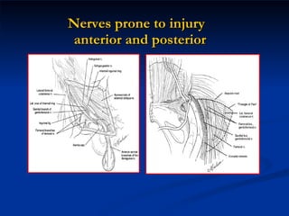 Nerves prone to injury  anterior and posterior 