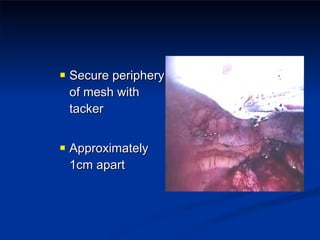 Secure periphery of mesh with tacker Approximately 1cm apart 