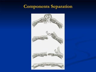Components Separation 