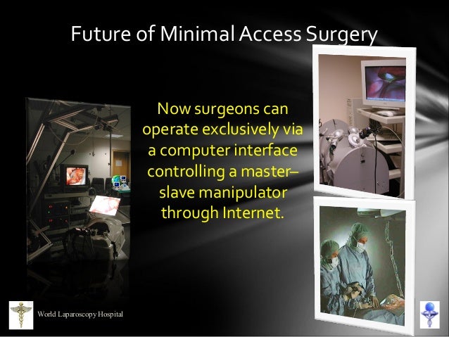 Introduction of Laparoscopic Surgery Introduction of Laparoscopic Surgery