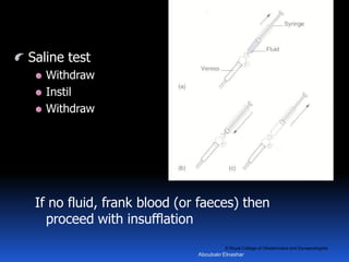 © Royal College of Obstetricians and Gynaecologists
Saline test
Withdraw
Instil
Withdraw
If no fluid, frank blood (or faeces) then
proceed with insufflation
Aboubakr Elnashar
 