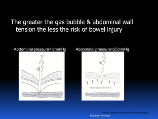 © Royal College of Obstetricians and Gynaecologists
The greater the gas bubble & abdominal wall
tension the less the risk of bowel injury
Abdominal pressure= 8mmHg Abdominal pressure=25mmHg
Aboubakr Elnashar
 