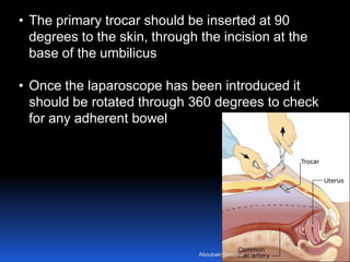 © Royal College of Obstetricians and Gynaecologists
• The primary trocar should be inserted at 90
degrees to the skin, through the incision at the
base of the umbilicus
• Once the laparoscope has been introduced it
should be rotated through 360 degrees to check
for any adherent bowel
Aboubakr Elnashar
 
