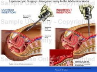 © Royal College of Obstetricians and Gynaecologists
Aboubakr Elnashar
 