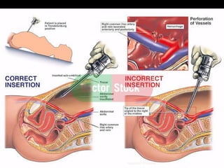 © Royal College of Obstetricians and Gynaecologists
Aboubakr Elnashar
 