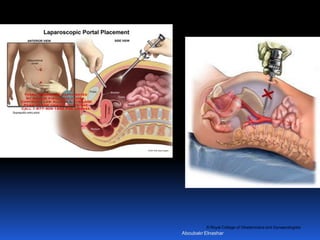 © Royal College of Obstetricians and Gynaecologists
Aboubakr Elnashar
 