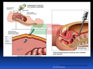 © Royal College of Obstetricians and Gynaecologists
Aboubakr Elnashar
 