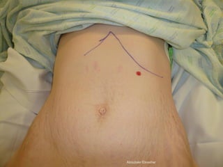 © Royal College of Obstetricians and Gynaecologists
Aboubakr Elnashar
 