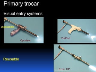 © Royal College of Obstetricians and Gynaecologists
Primary trocar
Visual entry systems
Endo TIP
VisiPort
Optiview
Disposable
Reusable
Aboubakr Elnashar
 