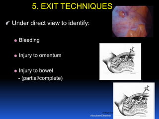 © Royal College of Obstetricians and Gynaecologists
Under direct view to identify:
Bleeding
Injury to omentum
Injury to bowel
- (partial/complete)
5. EXIT TECHNIQUES
Aboubakr Elnashar
 