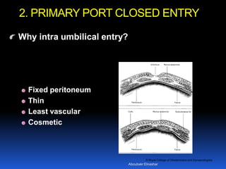 © Royal College of Obstetricians and Gynaecologists
Why intra umbilical entry?
Fixed peritoneum
Thin
Least vascular
Cosmetic
2. PRIMARY PORT CLOSED ENTRY
Aboubakr Elnashar
 
