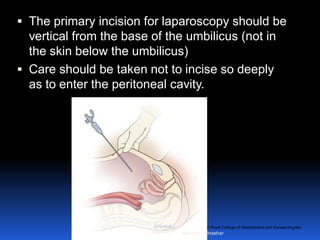 © Royal College of Obstetricians and Gynaecologists
 The primary incision for laparoscopy should be
vertical from the base of the umbilicus (not in
the skin below the umbilicus)
 Care should be taken not to incise so deeply
as to enter the peritoneal cavity.
Aboubakr Elnashar
 