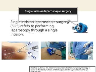Laproscopy Incision Infected laparoscopyingynecology-180309070515 (1).pptx