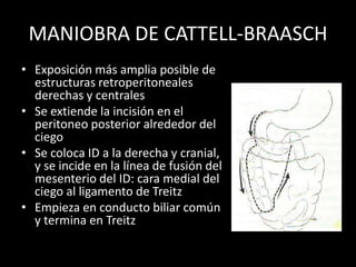 MANIOBRA DE CATTELL-BRAASCH
           • Exposición de
             retroperitoneo
             inframesocólico completo,
...