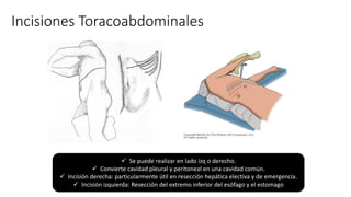 Incisiones Toracoabdominales
 Se puede realizar en lado izq o derecho.
 Convierte cavidad pleural y peritoneal en una cavidad común.
 Incisión derecha: particularmente útil en resección hepática electiva y de emergencia.
 Incisión izquierda: Resección del extremo inferior del esófago y el estomago
 