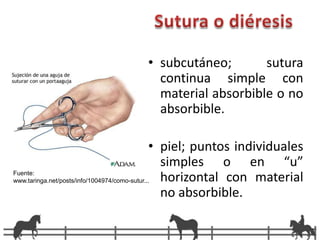 Peritoneo Fuente: http://2.bp.blogspot.com/_hbUVEXMuZeg/RuWTUDfqkkI/AAAAAAAAAMY/ZkN78fo32u8/s400/cirugia.jpg