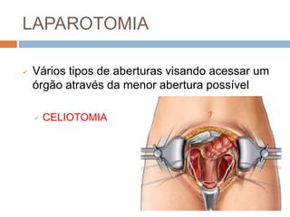 Laparotomia e Laparoscopia