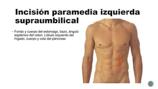  Fondo y cuerpo del estomago, bazo, ángulo
esplénico del colon, Lóbulo izquierdo del
hígado, cuerpo y cola del páncreas
 