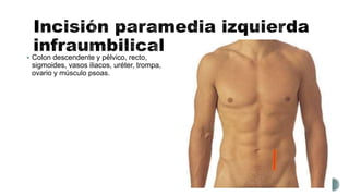  Colon descendente y pélvico, recto,
sigmoides, vasos iliacos, uréter, trompa,
ovario y músculo psoas.
 