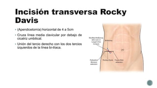  (Apendicetomía) horizontal de 4 a 5cm
 Cruza línea media clavicular por debajo de
cicatriz umbilical.
 Unión del tercio derecho con los dos tercios
izquierdos de la línea bi-ilíaca.
 